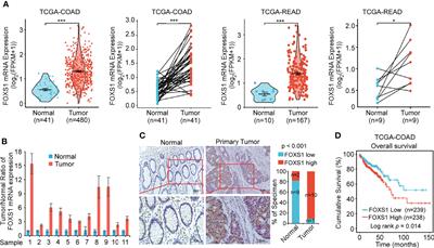 FOXS1 Promotes Tumor Progression by Upregulating CXCL8 in Colorectal Cancer